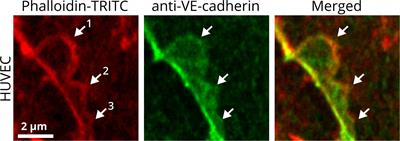 Autoregulatory “Multitasking” at Endothelial Cell Junctions by Junction-Associated Intermittent Lamellipodia Controls Barrier Properties